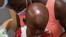 Diagnostic précoce du cancer chez l’enfant&nbsp;: l’exemple du Sénégal